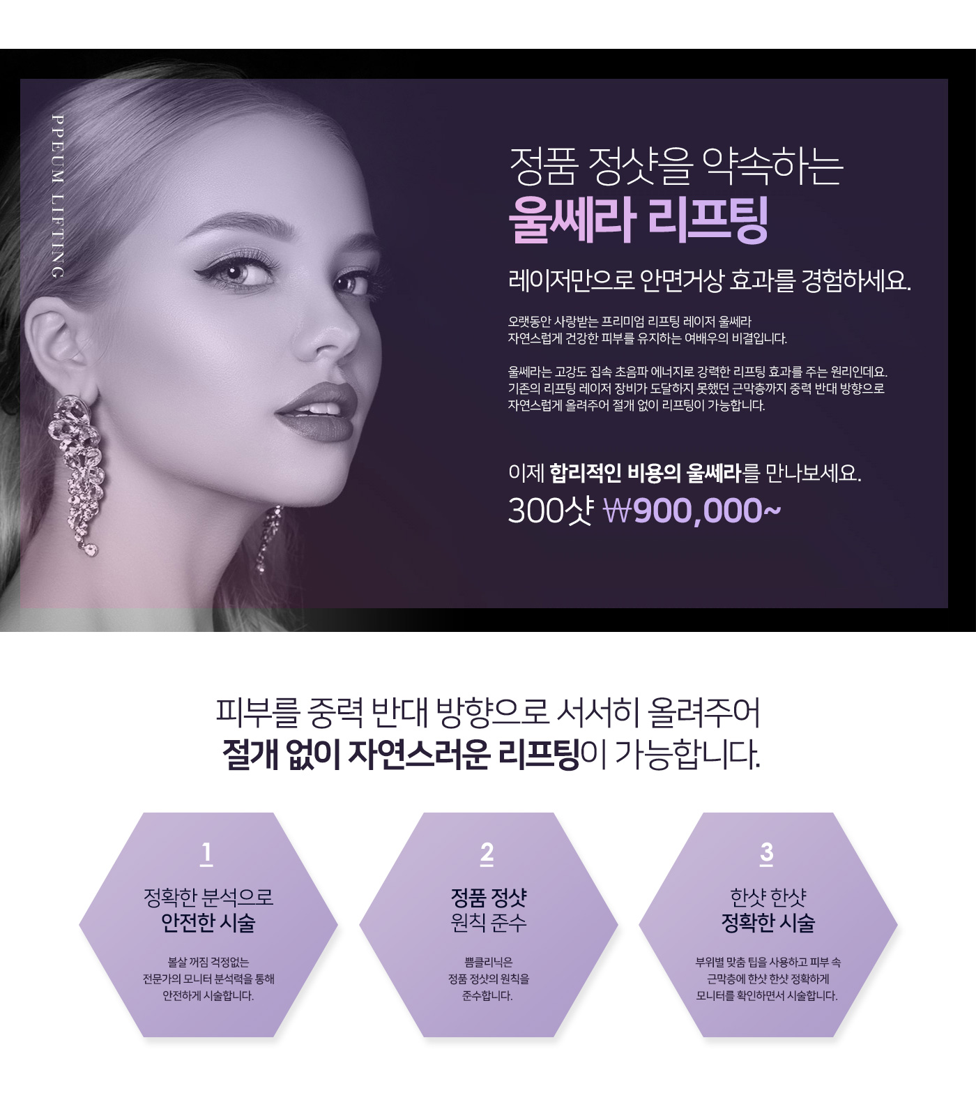 울쎄라리프팅, 울쎄라 가격, 300샷